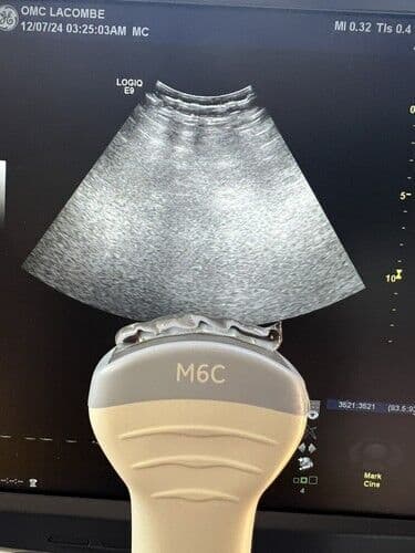 GE M6C-D (5499598) Ultrasound Transducer for LOGIQ E9 Systems