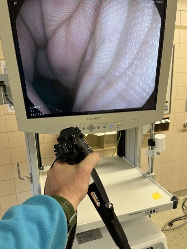 Pentax EC-3890FK2 | HD Colonoscope | 90K Series Video Scope | P/N EC-3890FK2 | Large 3.8mm Therapeutic Channel | Pentax EPK-i Processor Parts