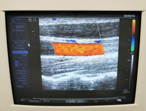 Siemens VFX 9-4 Linear Array Ultrasound Transducer thumbnail 4