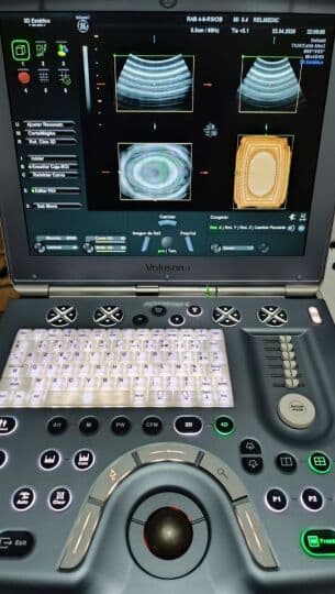 GE Voluson i Portable OB/GYN Ultrasound System thumbnail 7
