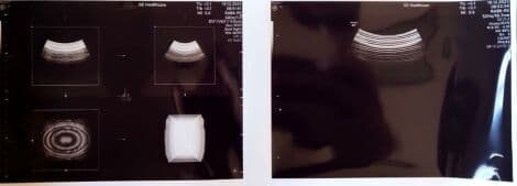 GE RAB6-RS 4D Convex Ultrasound Transducer thumbnail 4