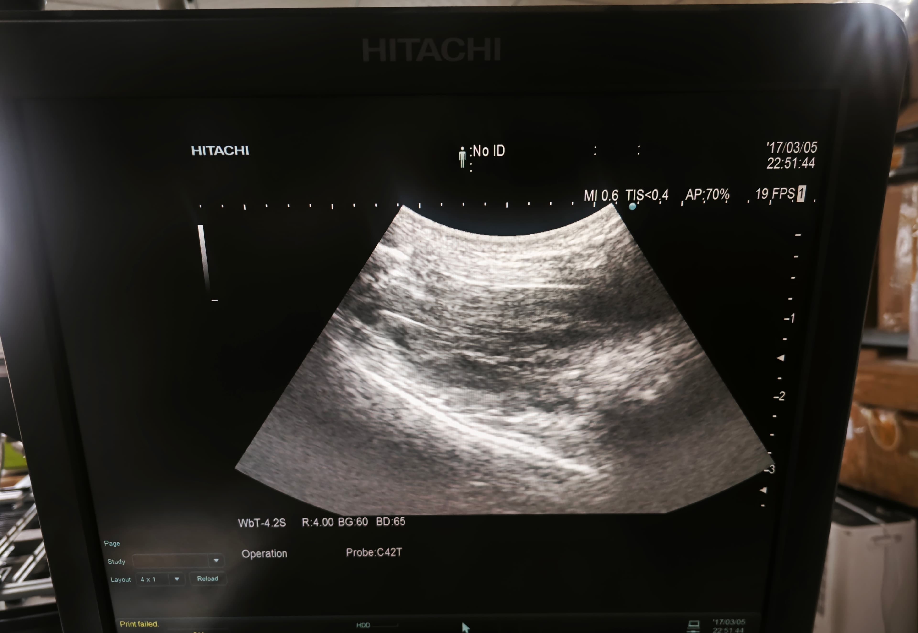 Used Hitachi C42T Intraoperative Curved Array Ultrasound Probe Tested Working thumbnail 5