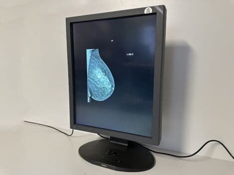 Diagnostic X-Ray Monitor by Totoku — ME511L / B thumbnail 2