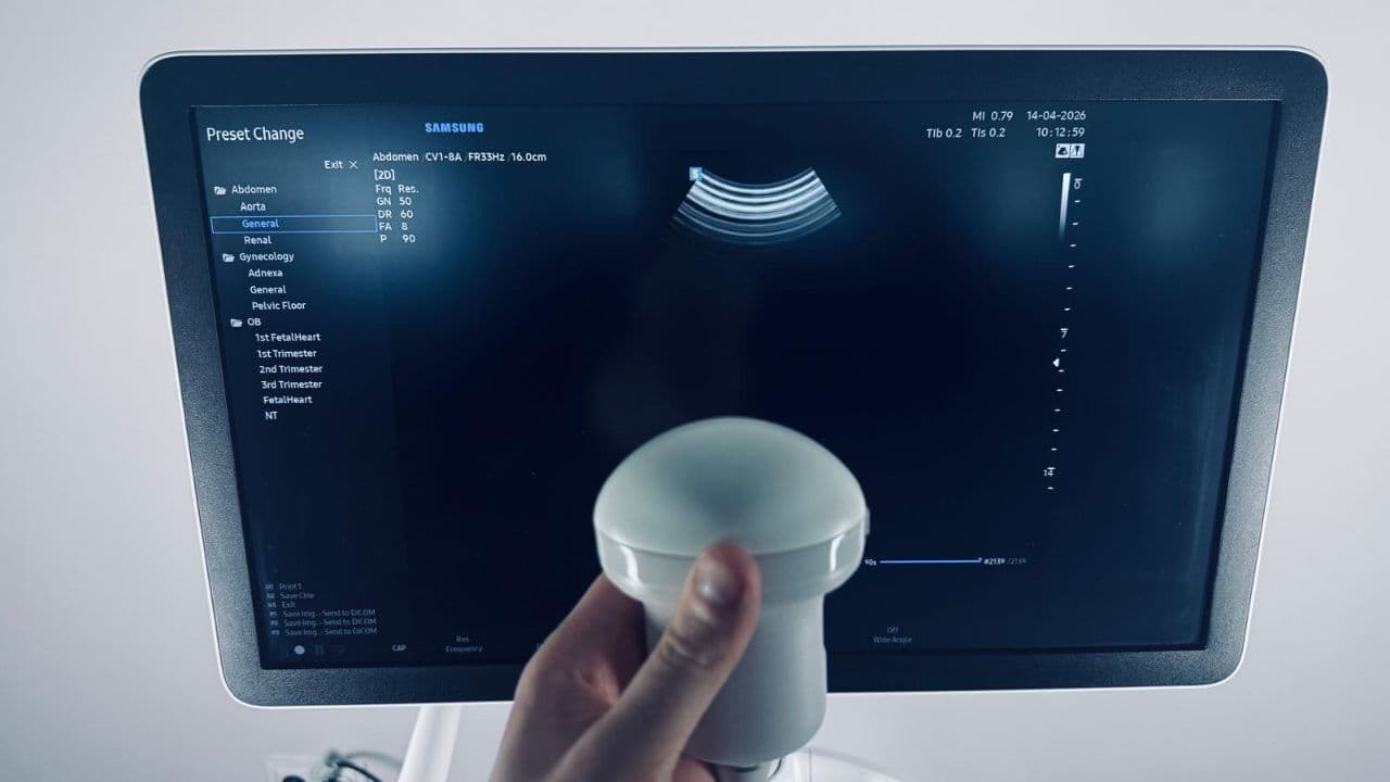 For Sale SAMSUNG HERA W10 2022 with 3 probes included ex demo OB / GYN Ultrasound thumbnail 7