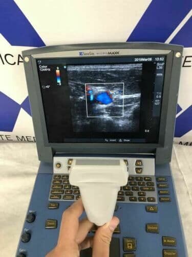 Sonosite Micromaxx Portable Ultrasound System with L38e Linear Array Vascular Probe thumbnail 4