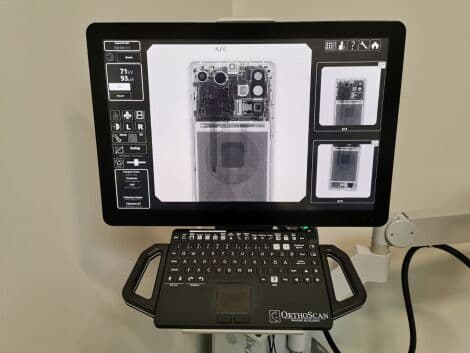 Orthoscan FD Pulse Mini C-Arm System thumbnail 3