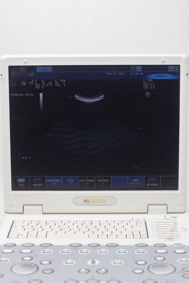 Esaote MyLab 25 Gold Portable Ultrasound System thumbnail 8