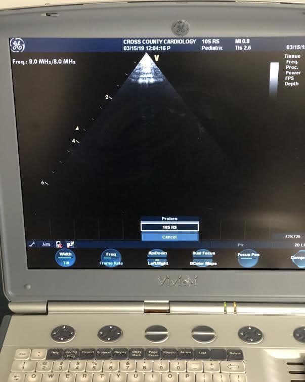 GE 10S-RS Sector Array Ultrasound Transducer thumbnail 3