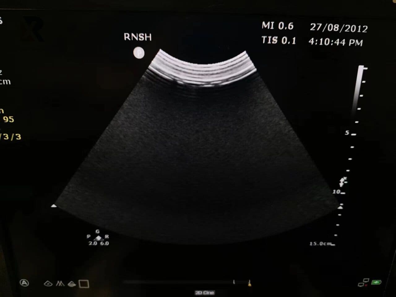 Philips C6-2 Curved Array Ultrasound Transducer for EPIQ, Affiniti, and CX50 Systems thumbnail 4