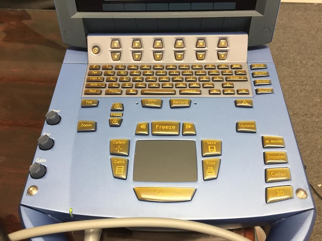 Sonosite MicroMaxx Portable Ultrasound System thumbnail 5