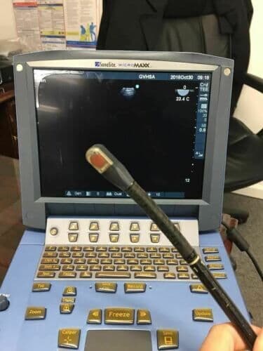 Sonosite MicroMaxx Portable Ultrasound System thumbnail 5