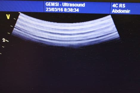 GE 4C-RS Convex Array Ultrasound Transducer thumbnail 4