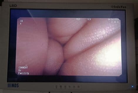 Pentax EPK-i5000 High Definition Endoscopy Processor thumbnail 7