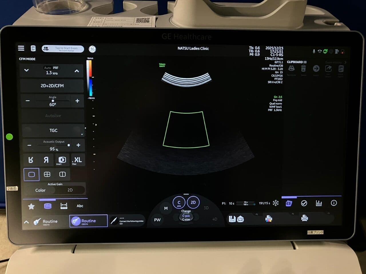 Advanced 4D GE Voluson Swift BT23 OB/GYN Ultrasound System thumbnail 5