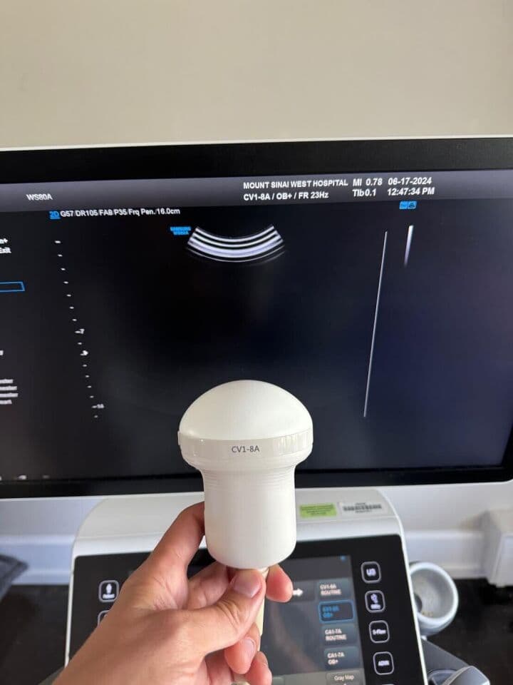 Samsung WS80 Elite Premium Ultrasound System thumbnail 3