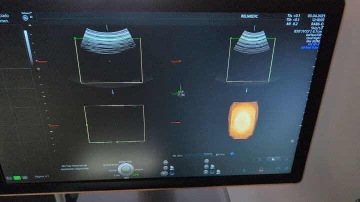 GE Voluson E8 OB/GYN Ultrasound System thumbnail 9
