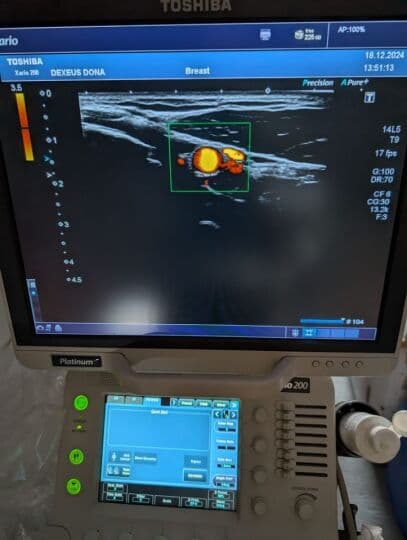 Toshiba PLU-1005BT Linear Ultrasound Transducer thumbnail 6