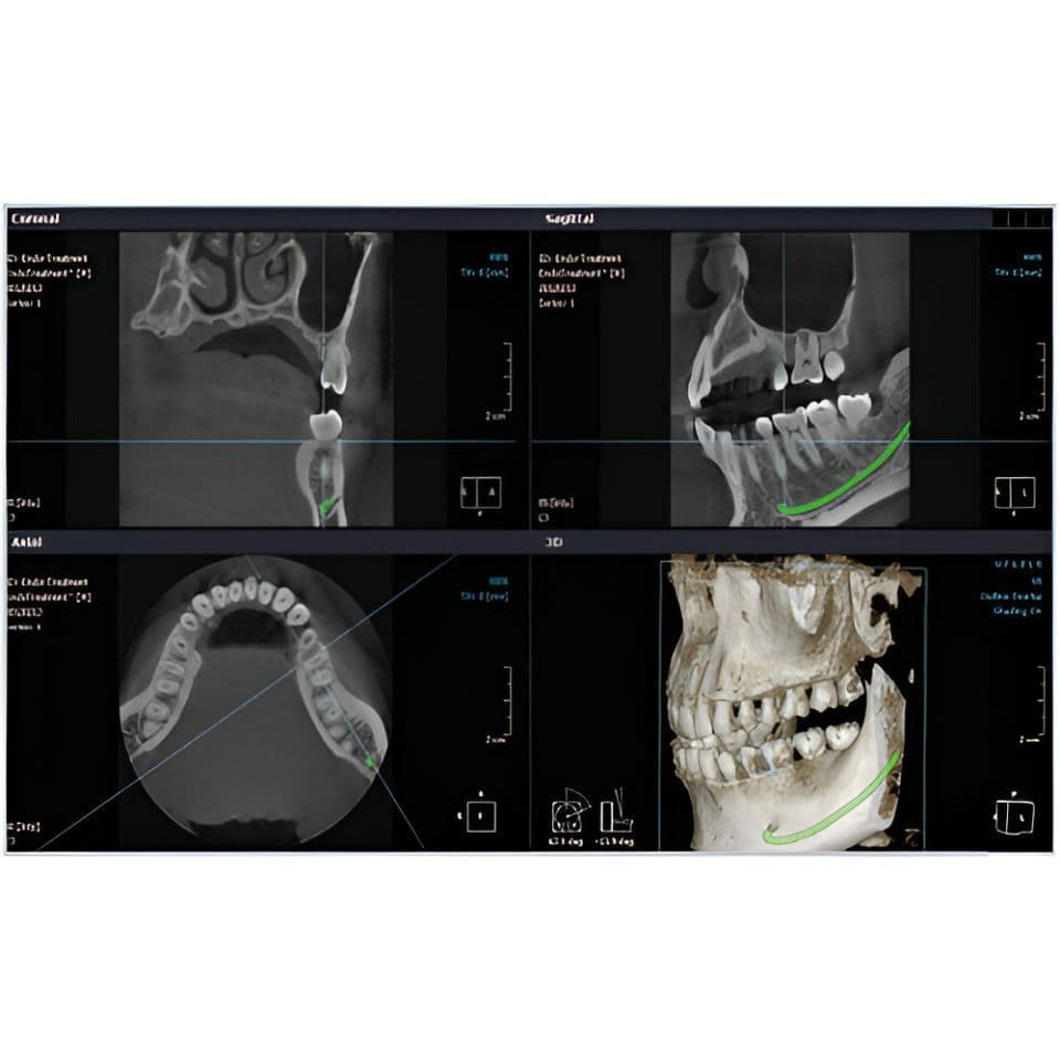 RAYSCAN Alpha Pan + CBCT (10x10 FOV) 3D Dental X-Ray System thumbnail 6
