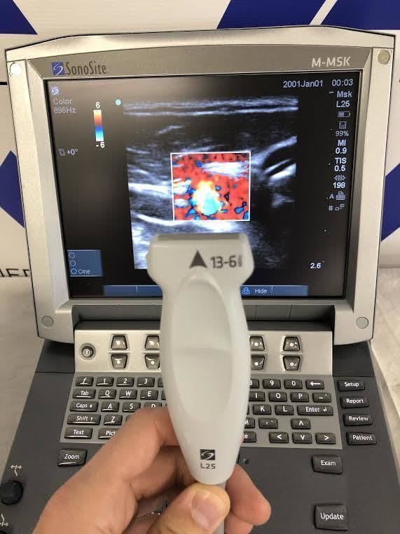 Sonosite L25x Linear Ultrasound Transducer thumbnail 2