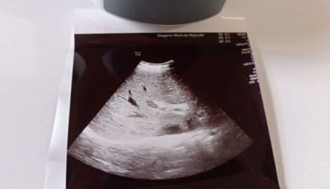 GE EM6C 4D Convex Matrix Ultrasound Transducer thumbnail 7