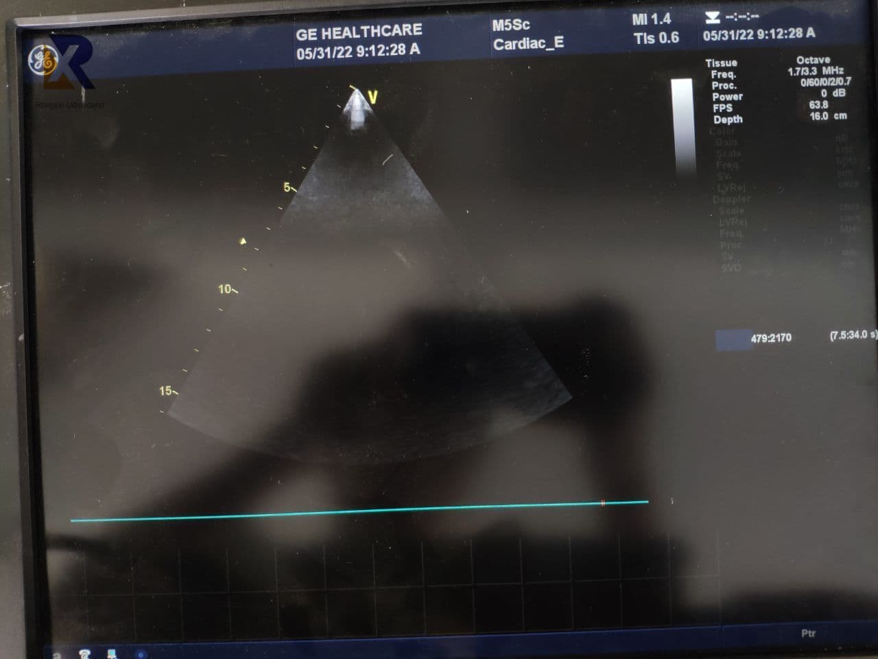 GE M5SC-D Phased Array Ultrasound Transducer thumbnail 4