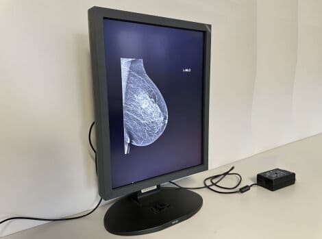 Totoku ME315L / MDL2105A Diagnostic Display Monitor