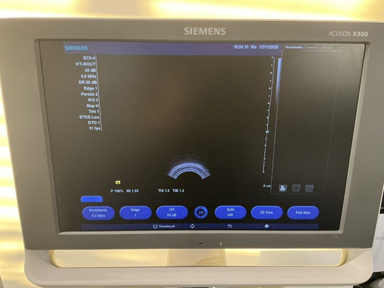 For Sale SIEMENS X300 OB / GYN Ultrasound thumbnail 2