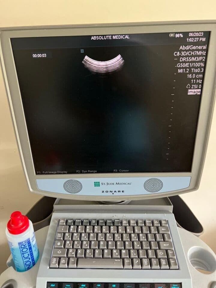 ZONARE C8-33D 3D Ultrasound Transducer thumbnail 3