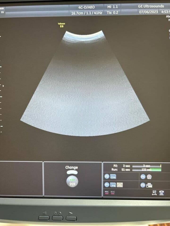 GE 4C-D Convex Ultrasound Transducer thumbnail 2