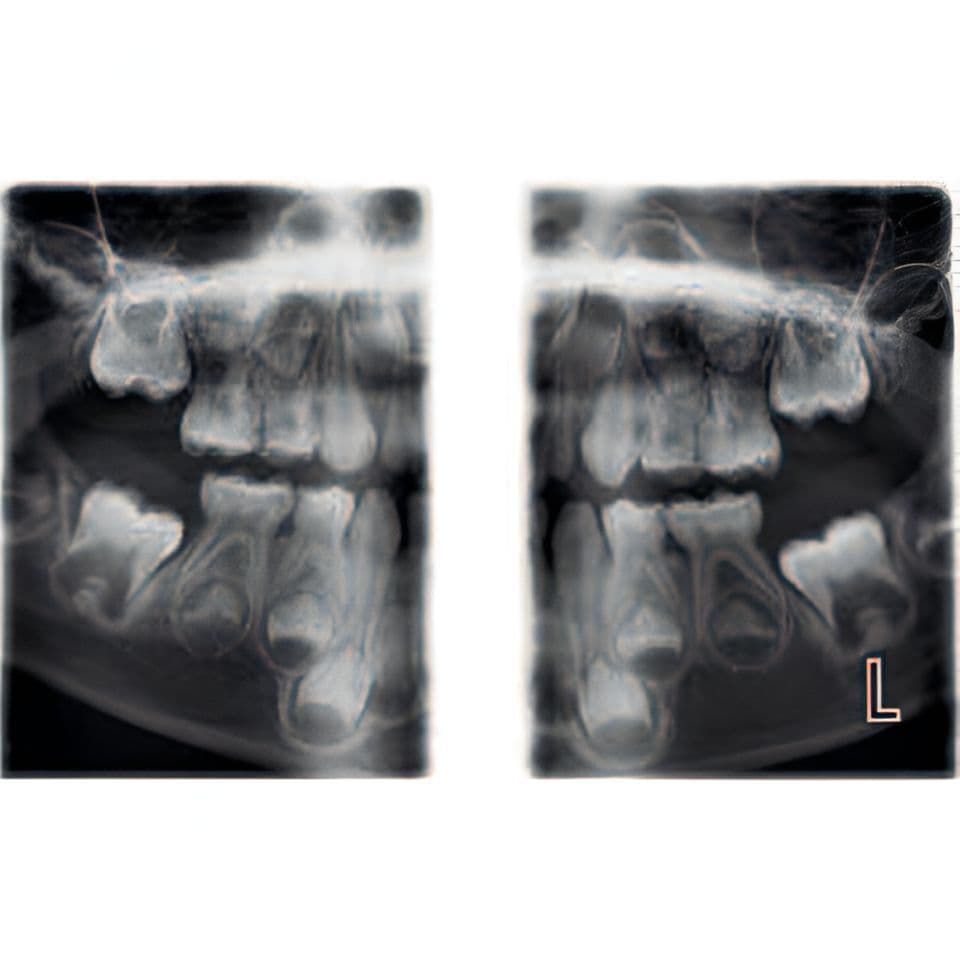 Planmeca ProMax Pan Dental X-Ray System thumbnail 5