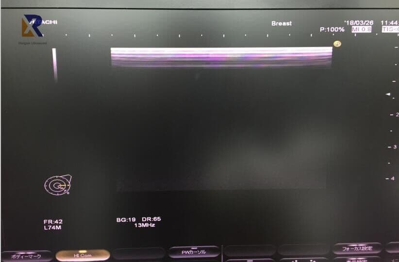 Hitachi EUP-L74M Linear Ultrasound Transducer thumbnail 3