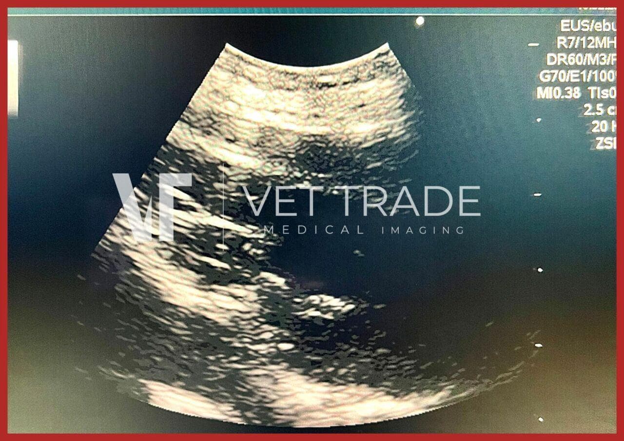 FUJIFILM EB-530US Ultrasound Bronchoscope thumbnail 4