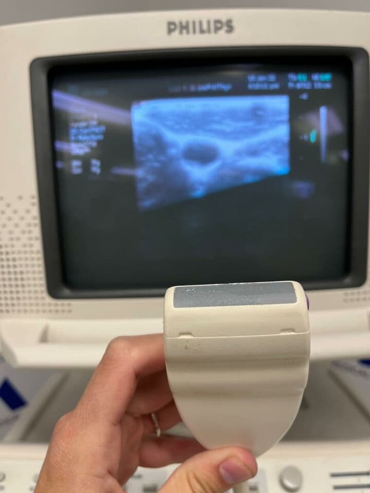 Philips HDI 5000 Ultrasound System with Three Probes thumbnail 4