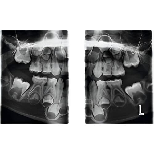 Planmeca Pan + CBCT (8x8 FOV) 3D Dental X-Ray System thumbnail 9