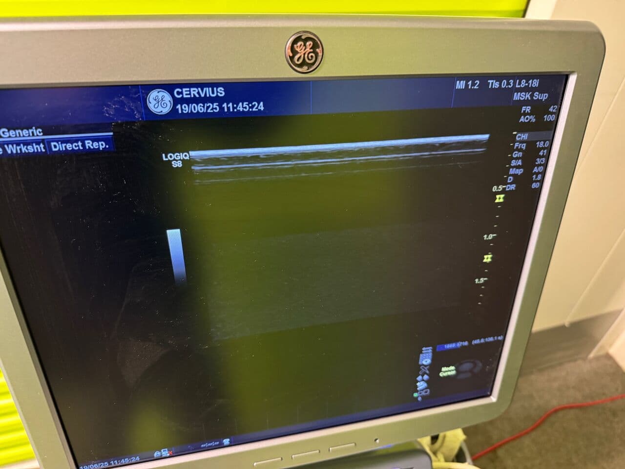 GE L8-18i-D Linear Array Ultrasound Probe thumbnail 2