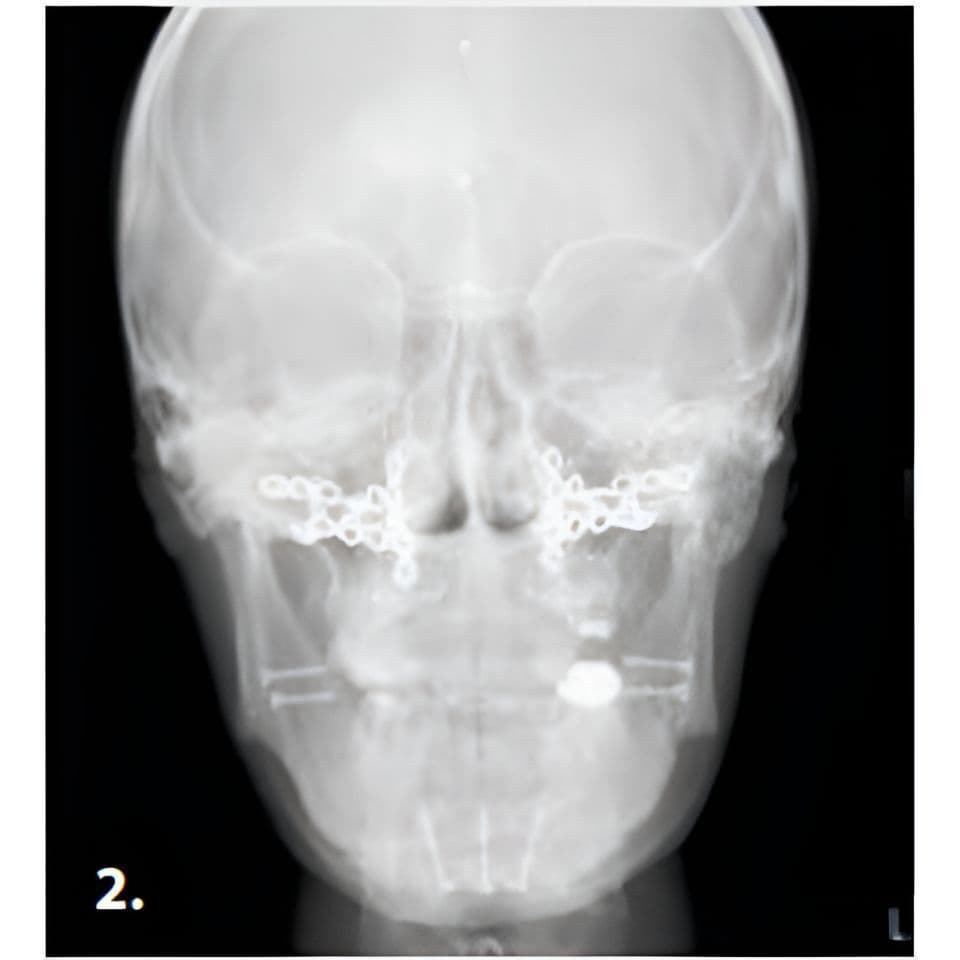 MyRay Hyperion X9 PRO Pan/Ceph/CBCT Dental X-Ray with 13x16 FOV thumbnail 9