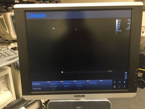Chison QBit 7 4D OB/GYN Ultrasound System thumbnail 3