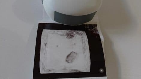 GE EM6C 4D Convex Matrix Ultrasound Transducer thumbnail 3