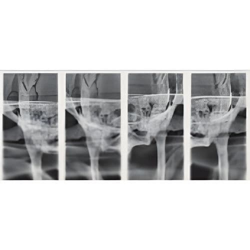 Sirona Orthophos XG Pan Panoramic Dental X-Ray System thumbnail 2