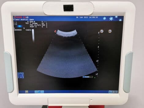 General Ultrasound System by Esaote — Mylab 60 with LA435, LA522E, and CA631 Probes thumbnail 3
