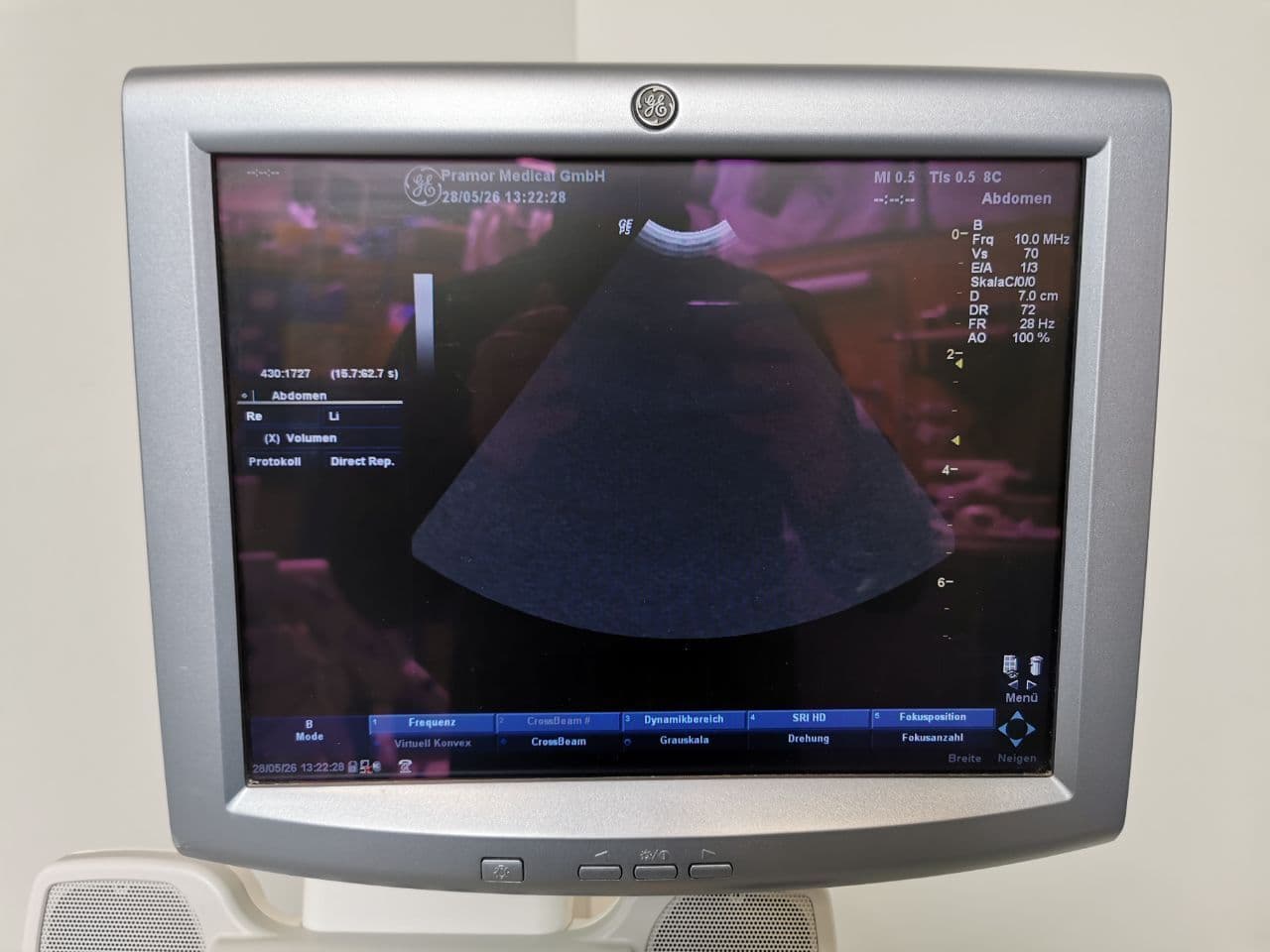 Micro-Convex GE Healthcare 8C Ultrasound Transducer thumbnail 5