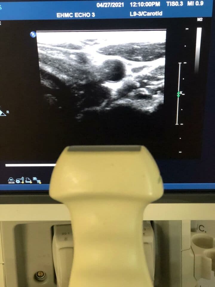 Philips IE33 Cardiovascular Ultrasound System thumbnail 7