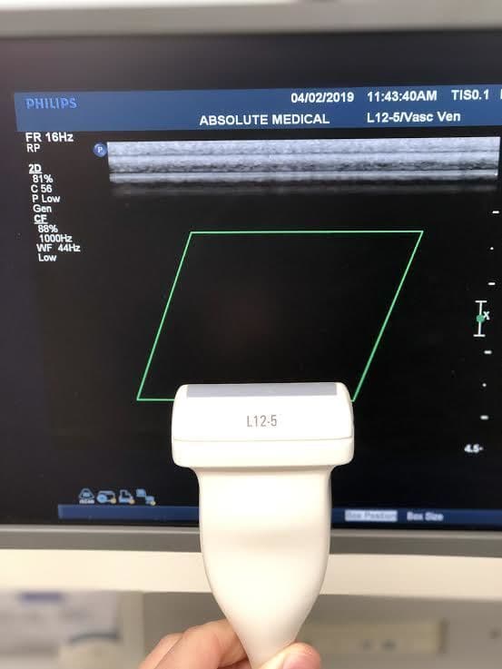 Philips L12-5 Linear Array Vascular Ultrasound Transducer Probe thumbnail 3
