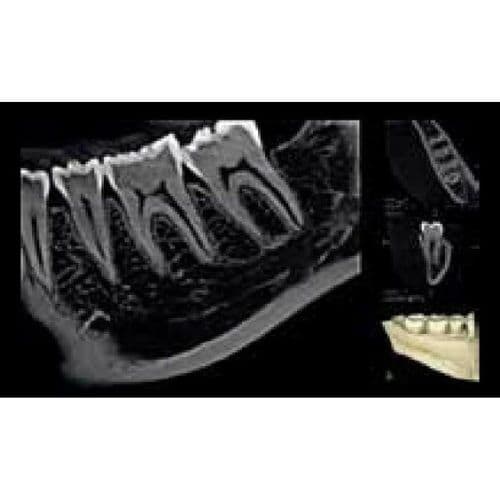 Carestream CS8100 3D Panoramic and CBCT Dental X-Ray System (2020) thumbnail 3