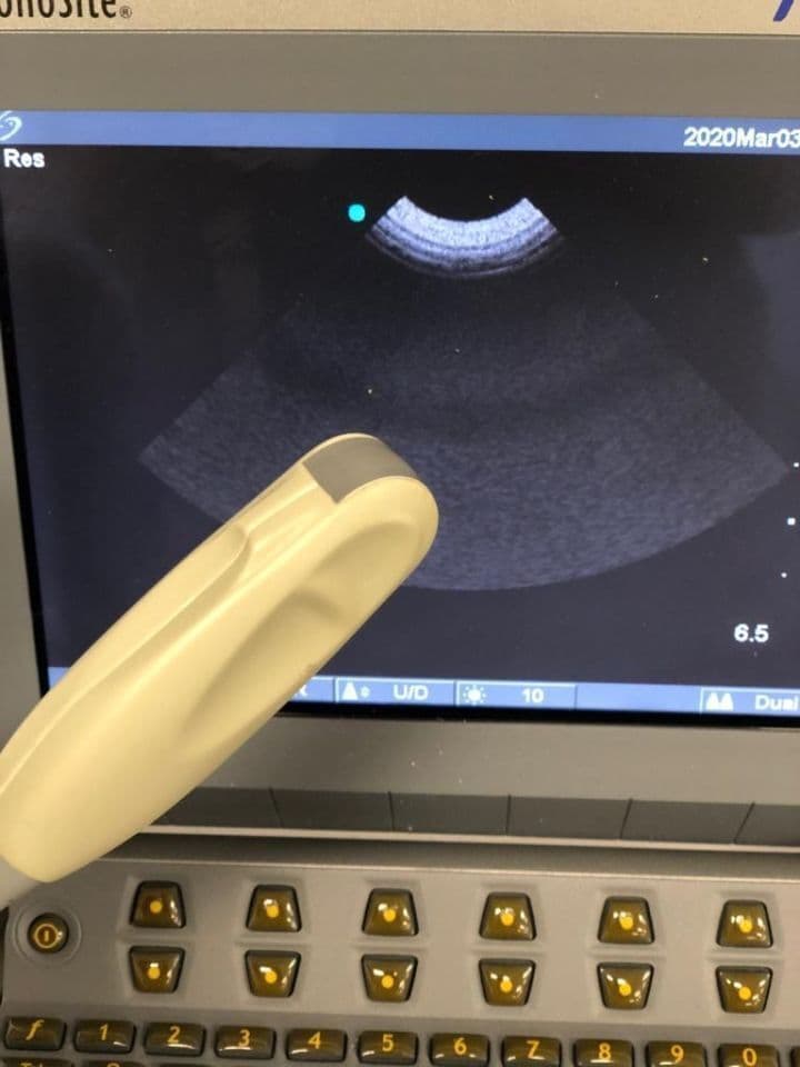 Sonosite C11 Ultrasound Transducer Probe