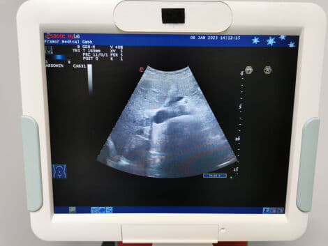 General Ultrasound System by Esaote — Mylab 60 with LA435, LA522E, and CA631 Probes thumbnail 4