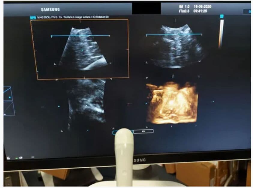 Samsung Medison V5-9 3D/4D Volume Convex Ultrasound Transducer image 1