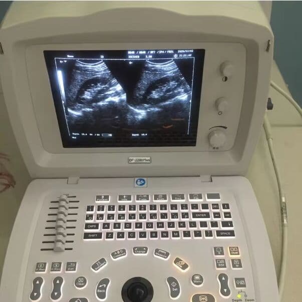 Mindray DP2200 Plus Portable Ultrasound Scanner
