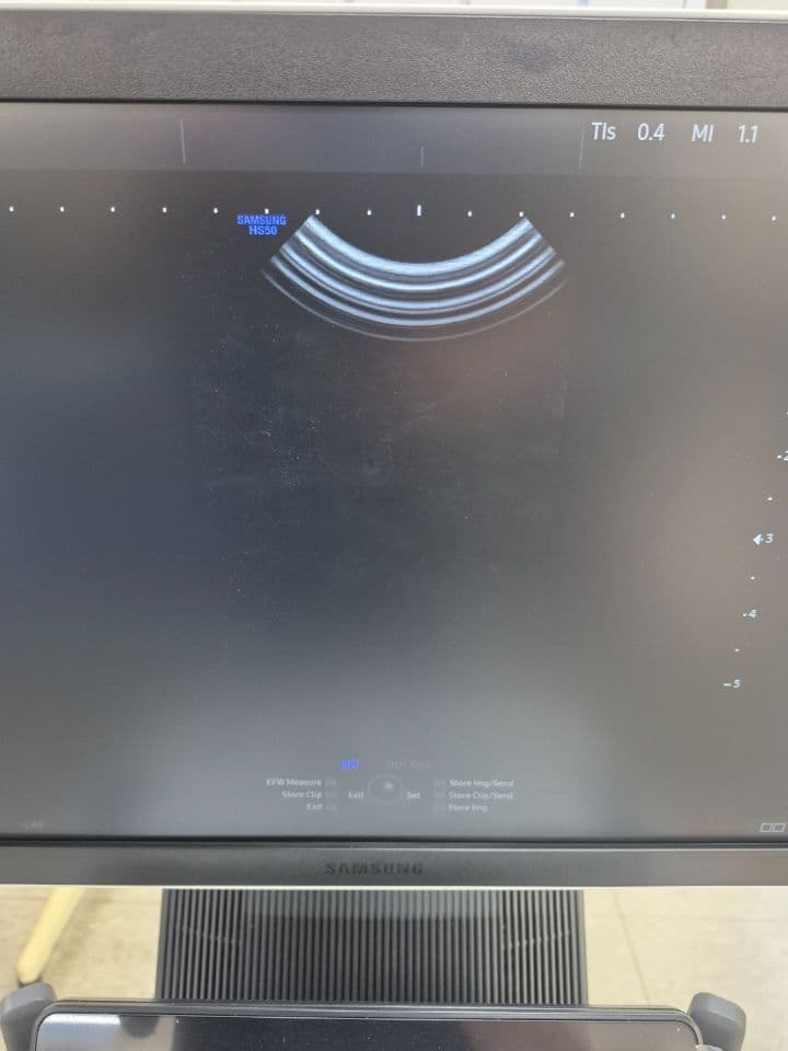 Pediatric Convex Ultrasound Transducer — Samsung CA4-10M thumbnail 6