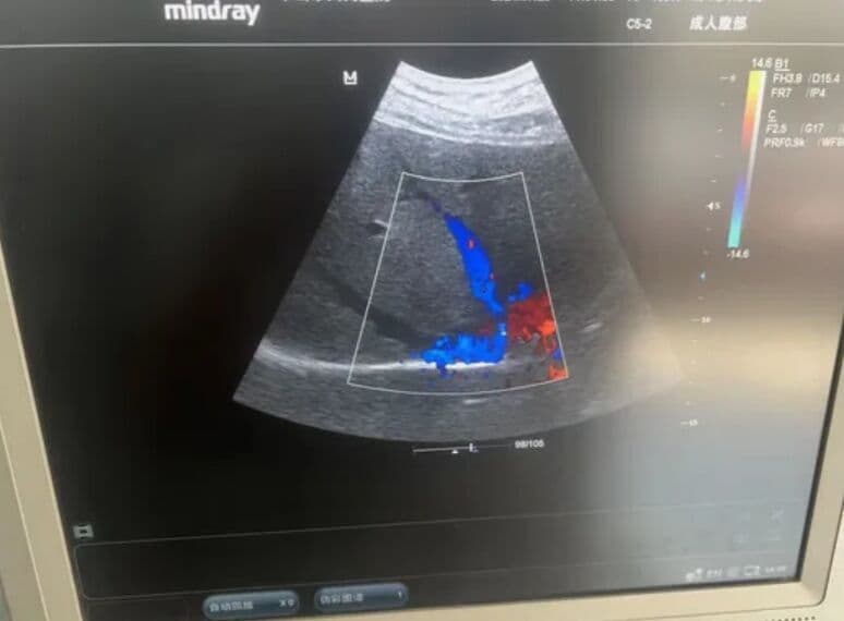 Mindray DC-7 Ultrasound Machine thumbnail 3